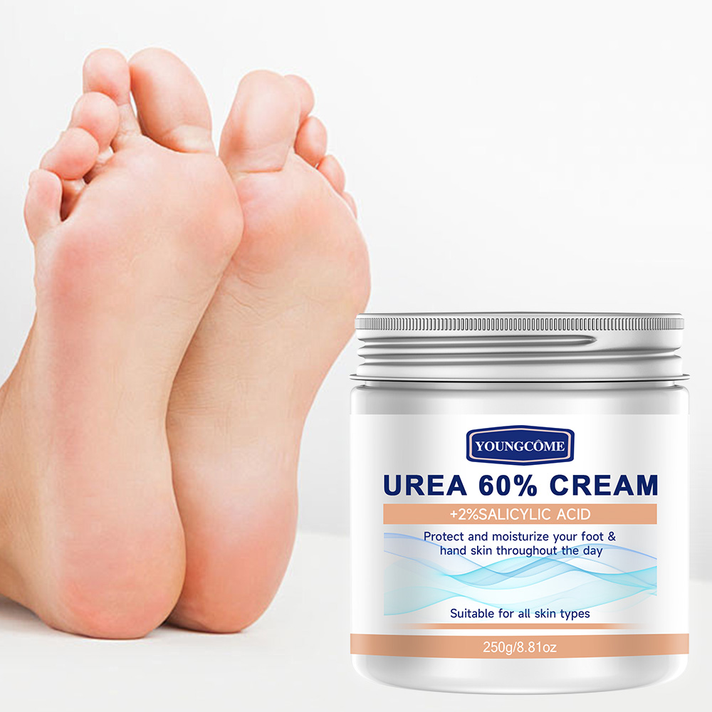 YOUNGCOME 250G Harnstoffcreme  – Urea Foot Cream Bewertung und Preis