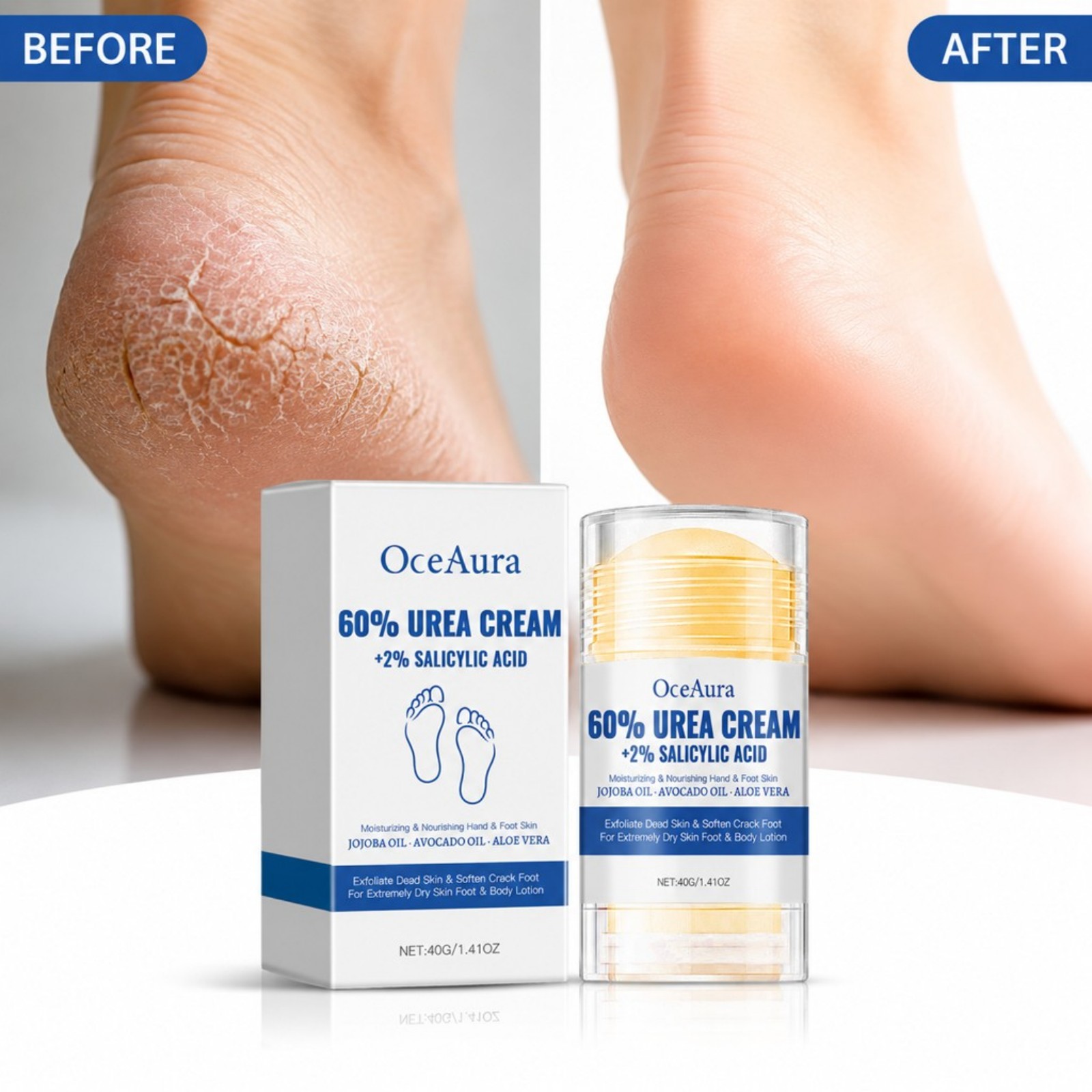 60% Urea Fußpflege-Creme-Stick – Urea Foot Cream Bewertung und Preis