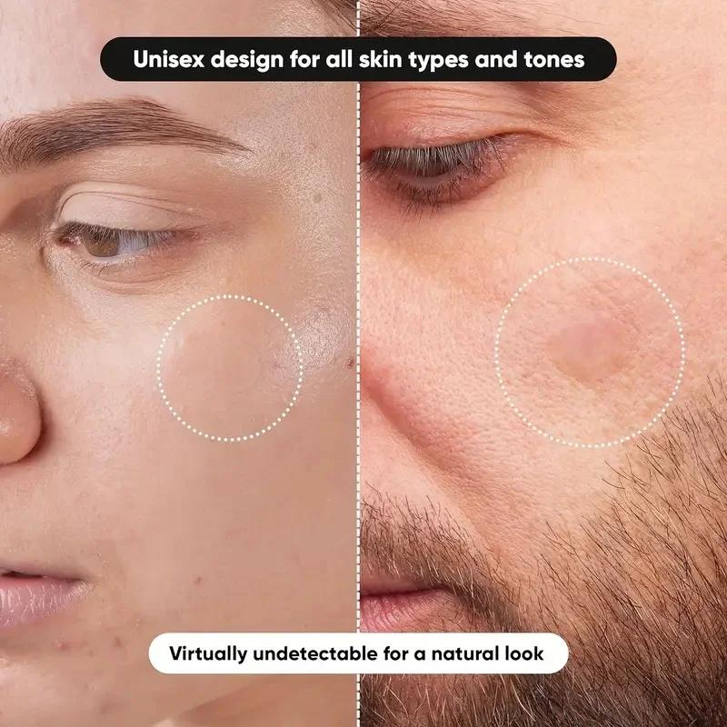 360 Stück/Karton Akne-Pflaster – Face Oil Bewertung und Preis