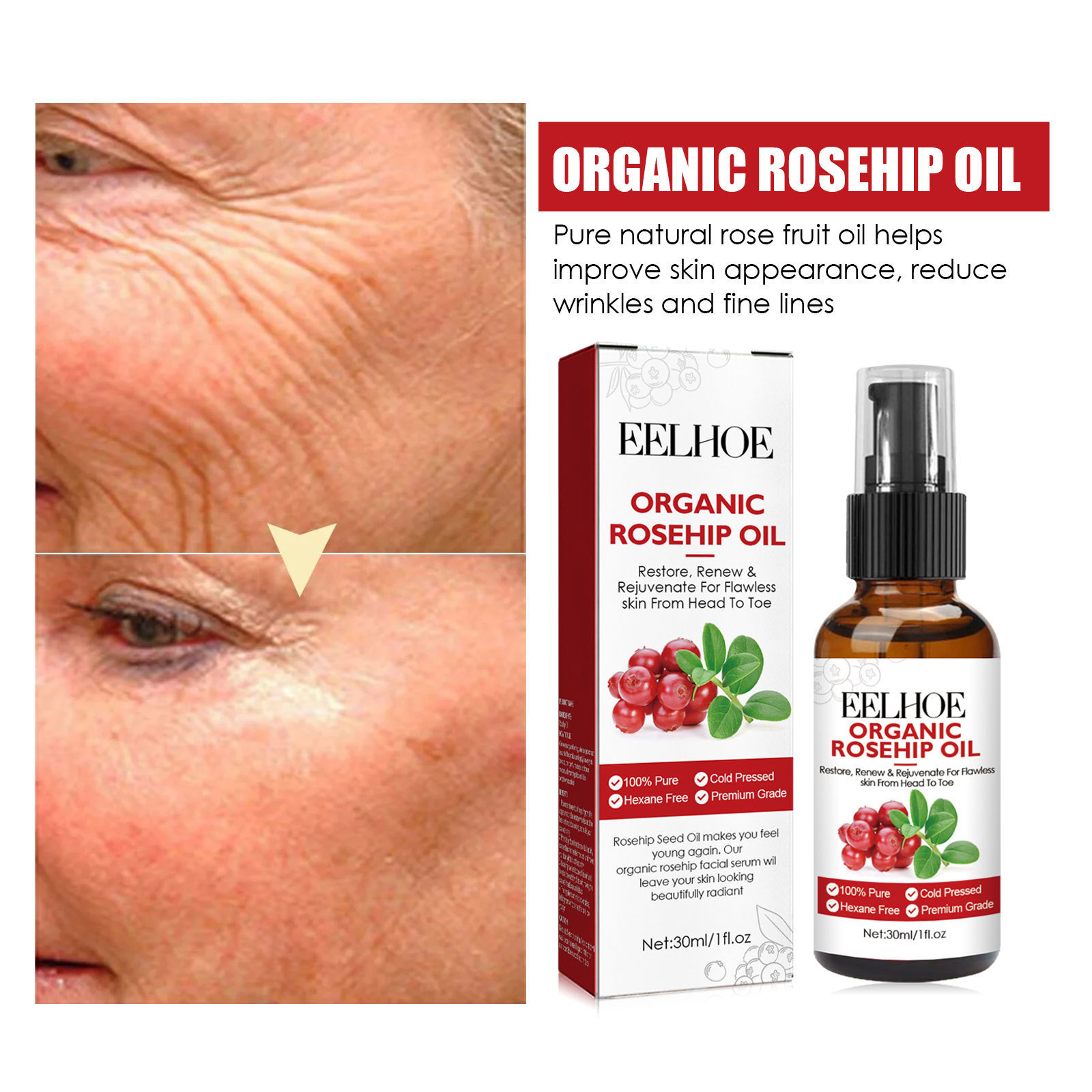 30 ml Hagebuttenöl-Gesichtsser – Face Oil Rosehip Bewertung und Preis